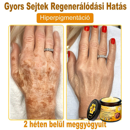🌟 ZödVita® Méhméreg Bőr Helyreállító Krém 🔥Természetes Öregedésgátló, Feszesíti a Bőrt, Csökkenti a Ráncokat– 50ml