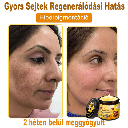 🌟 ZödVita® Méhméreg Bőr Helyreállító Krém 🔥Természetes Öregedésgátló, Feszesíti a Bőrt, Csökkenti a Ráncokat– 50ml